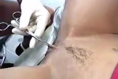 Colocando piercing na buceta